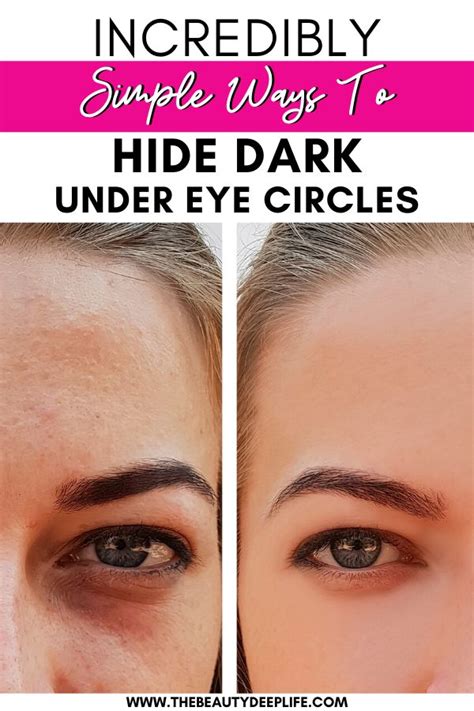 Incredibly Simple Ways To Hide Dark Under Eye Circles The Beauty Deep Life Dark Circles