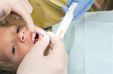 Fluoride Treatment Dentist Ogdensburg New York Jessica Barr Dds