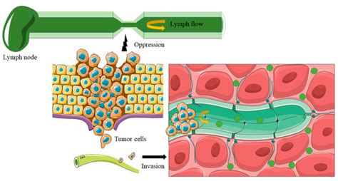 Cancers Free Full Text Mapping Lymph Node During Indocyanine Green