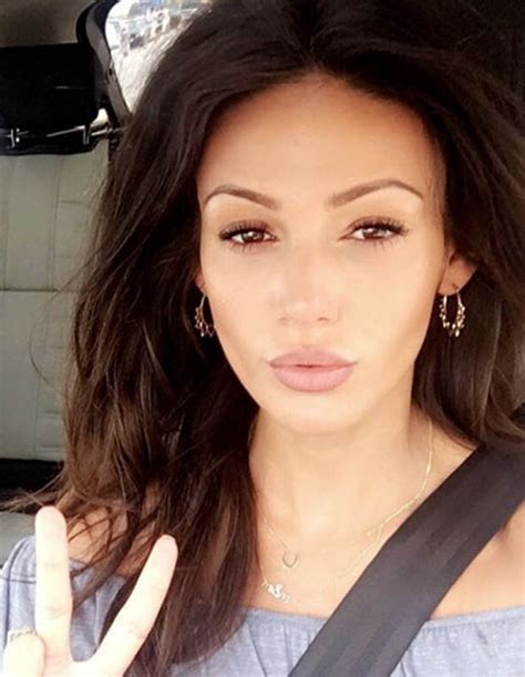 Chloe Goodman Opens Up Over Botched Cheek Fillers Daily Star