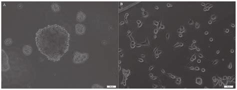 Morphology Of Tumor Spheres A Primary Tumor Spheres Formed In The