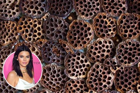 What Is Trypophobia And What Causes A Fear Of Holes Symptoms Treatment And Celebrity Sufferers