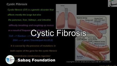Cystic Fibrosis Biology Lecture Sabaqpk Youtube