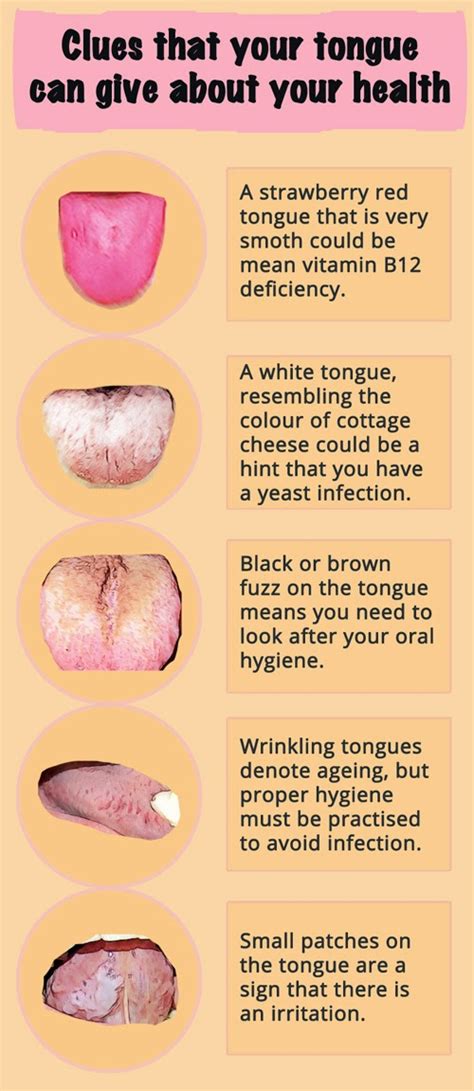 Pin By Stace King On Feeling Better Tongue Health Health Human Body