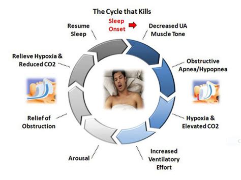 Sleep Apnea Treatments And Prevention Without Masks