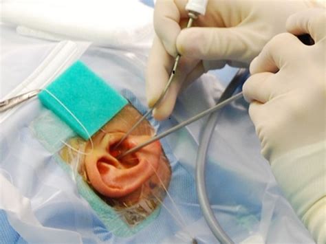 Ear Surgeries Aahan Ent Clinic Drajay Doiphode