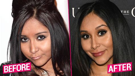 Jersey Shore Cast S Shocking Plastic Surgery Transformations Revealed