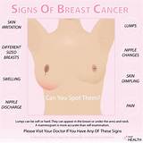What Doctor Do I See For Breast Pain Photos