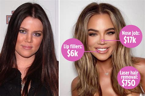 How Khloé Kardashian Has Spent £40k On Her Face Including £14k On Nose Jobs And £5k Lip Fillers