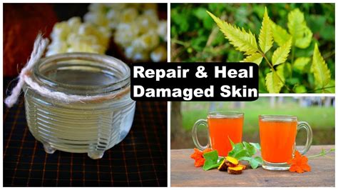 5 Remedies To Repair And Heal Damaged Skin Naturally Youtube
