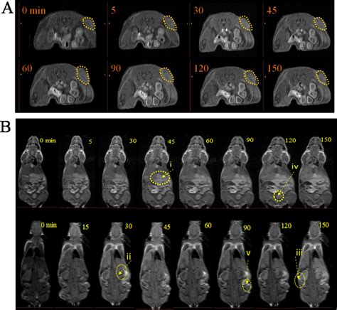 In Vivo T Weighted MRI Of BALB C Nude Female Mice Bearing