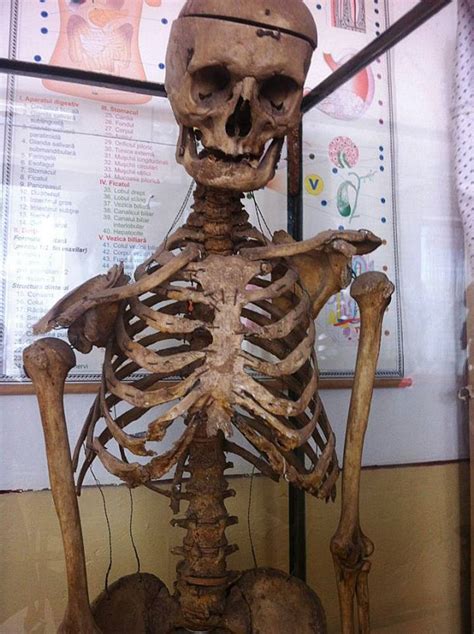 Former head teacher's skeleton is allowed to hang in biology classroom ...