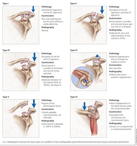 Pin By Michelle Miranda On Pt Shoulder Injuries Rotator Cuff