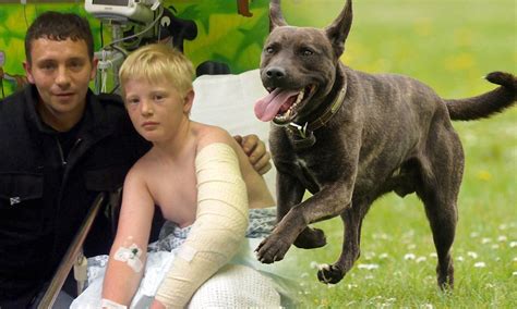 Real Life Lassie Comes To The Rescue As Boy 11 Is Impaled On Metal