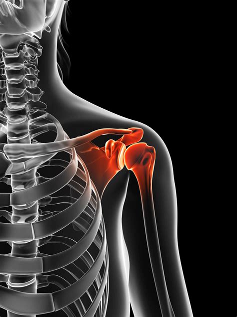 Shoulder Joint Dislocation Dislocated Your Shoulder Shoulder Physio