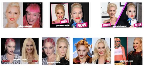 Gwen Stefani Plastic Surgery Before And After