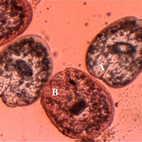Live A And Death B Protoscoleces Of Hydatid Cysts After Exposure