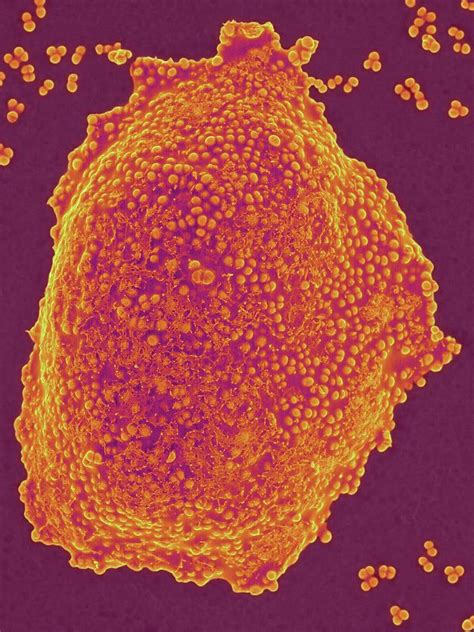 Staphylococcus Aureus Colony Mrsa Strain Photograph By Dennis Kunkel