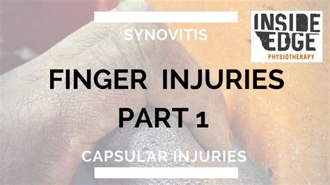 Climbers Finger Injuries Synovitis And Capsular Injuries Youtube