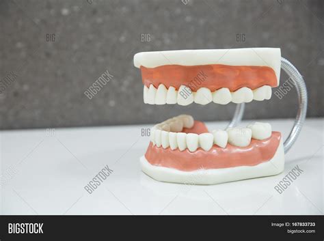 Upper Lower Jaw Dental Image And Photo Free Trial Bigstock