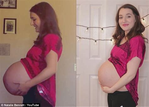 20 settimane di gravidanza con pancia gemellare