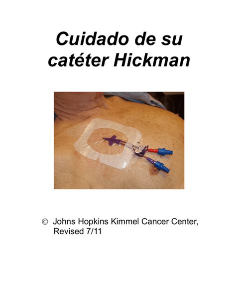 Care Of Your Hickman Catheter