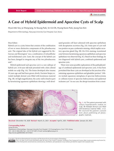 Pdf A Case Of Hybrid Epidermoid And Apocrine Cysts Of Scalp