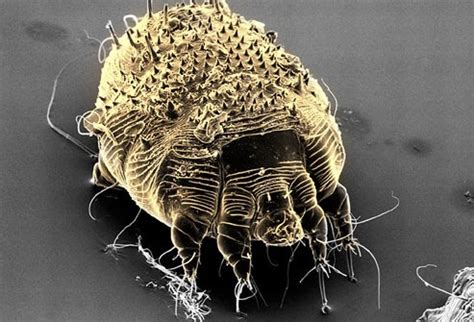 Black panthers are only black versions of these animals. Healthy Life: Scabies