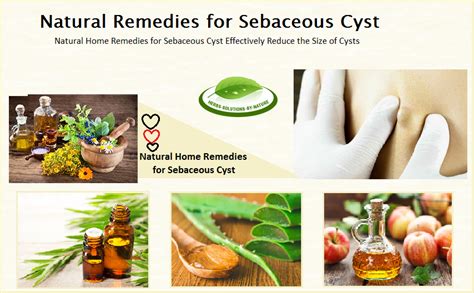 natural remedies for sebaceous cyst effectively reduce the size of cysts herbs solutions by