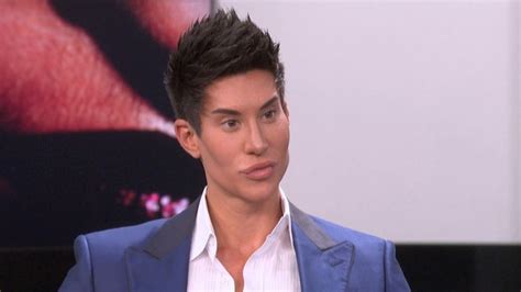 Human Ken Doll Reveals What His Next Shocking Surgery Will Be E News