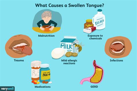 Causes Of A Swollen Tongue And Typical Remedies