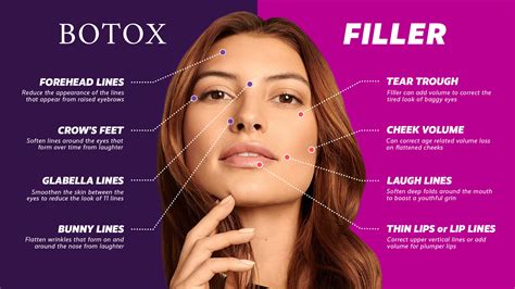 Are Botox And Fillers The Same