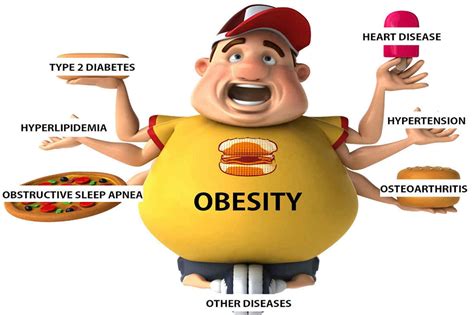 Hazards Of Obesity And Ways To Manage Weight Islamic Voice