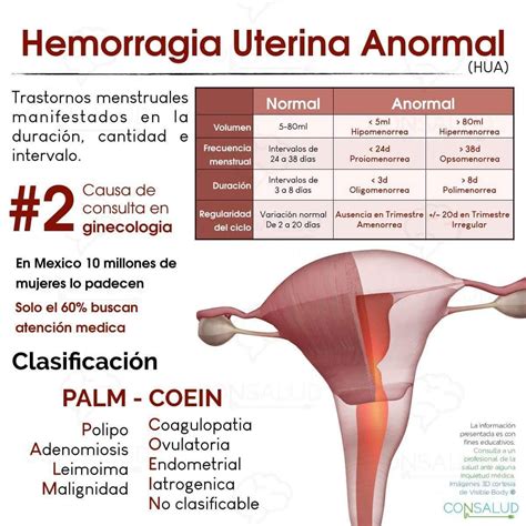 Hemorragia Uterina Iam Obstetricia Gineco Obstetricia Estudiante