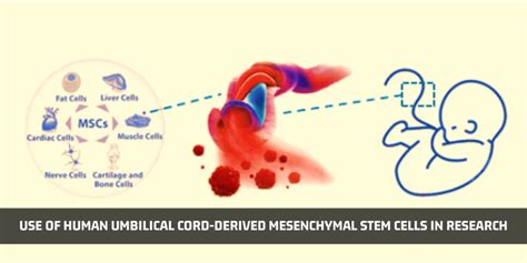 Stem Cells In Umbilical Cord Tissue To Treat Eczema