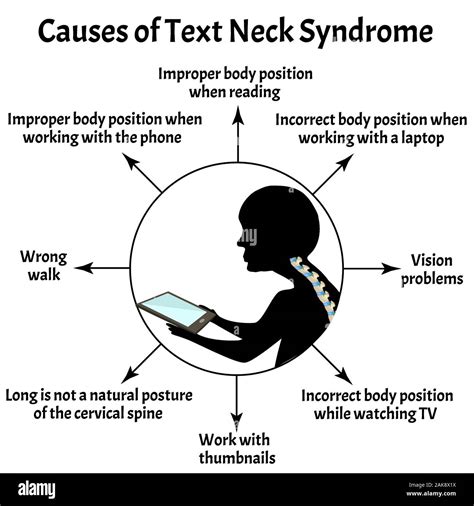 Causes Of Text Neck Syndrome Spinal Curvature Kyphosis Lordosis Of