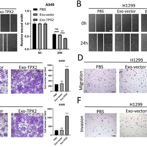 Exosomes From Cells With High Tpx2 Expression Promote Cell Invasion And