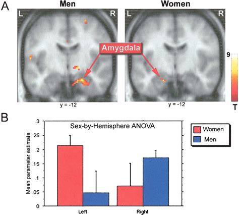Sex Related Hemispheric Lateralization Of Amygdala Function In Emotionally Influenced Memory An
