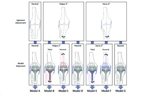 Diagram Of Varusvalgus Mediallateral Laxity And Tibialfemoral