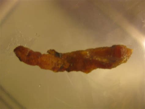 Worms Human Stool Parasites Xpicse Com