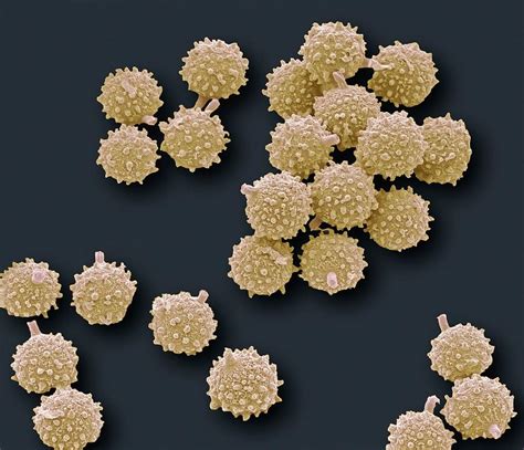 Puffball Fungus Spores Sem Photograph By Steve Gschmeissner Pixels