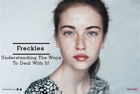Freckles Understanding The Ways To Deal With Them By Dr Gunjan Agarwal Lybrate