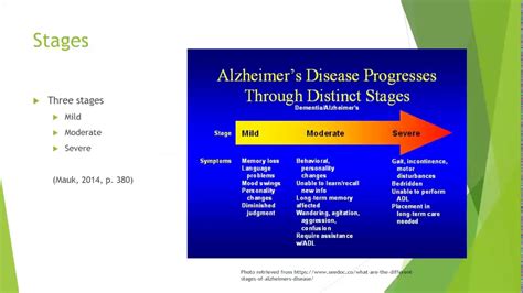 Alzheimers Dementia Powerpoint Nur341 Youtube