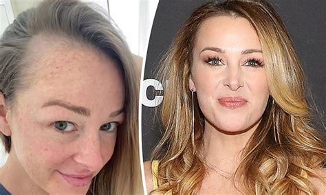 Married At First Sight Star Jamie Otis Speaks Out About Postpartum Hair Loss
