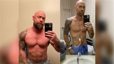 San Francisco Nurse Mike Shultz Shares Shocking Before And After Photos
