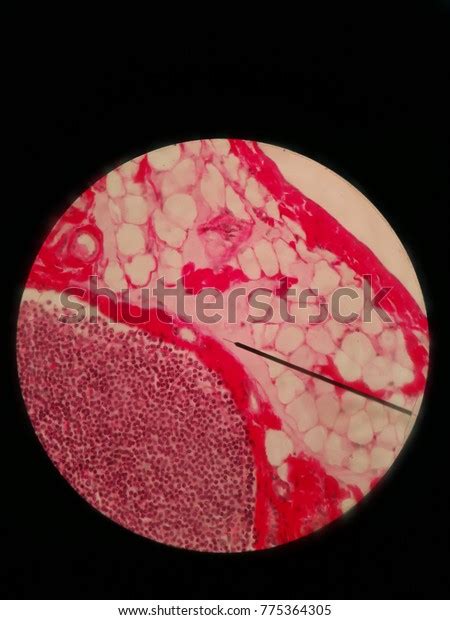 Histology Slide Adipose Tissue Erythrocytes Stock Photo Edit Now