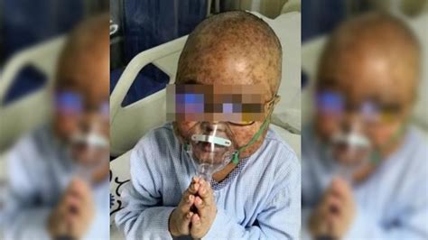 Niño chino de 5 años contrae leucemia y muere por culpa del tratamiento