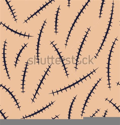 Surgical Stitches Clipart Free Images At Vector Clip Art