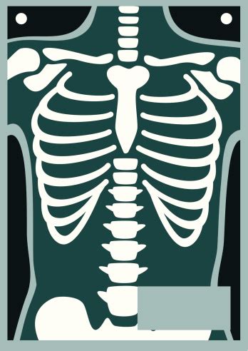Bbc science > human body & mind > the body > skeleton. Human Body X Ray Rib Cage Stock Illustration - Download ...