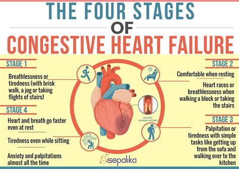 Stages Of Heart Failure St Anthony S Hospice